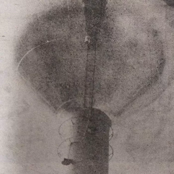 Black and white damaged image of the Selkirk water tower